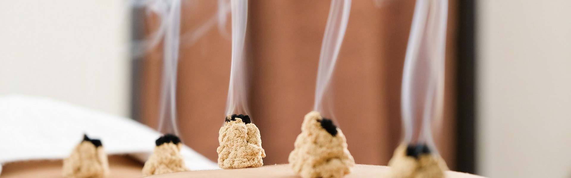 Meridiantherapie Meridiantherapie